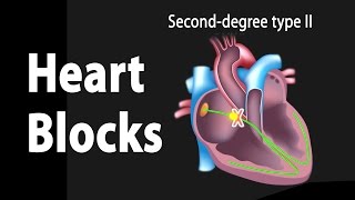 Heart Blocks Anatomy and ECG Reading Animation [upl. by Fredkin649]