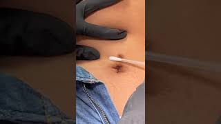 Belly Piercing Rehab with our Piercing Bump Treatment Flawless piercings with Base Laboratories 🥳 [upl. by Ailil]