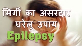 मिर्गी को जड़ से ख़त्म करें  Epilepsy Natural treatment  Mirgi ka illaj  मिर्गी का घरेलु इलाज [upl. by Anirol]