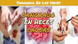 ⚕️🩺 SANGRE EN LAS HECES Causas y Tratamiento [upl. by Eramal78]