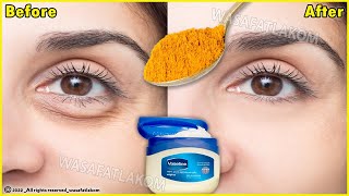 In just 3 days it removes wrinkles and bags under the eyes completely Dark Circle Puffy Eyes [upl. by Denzil644]