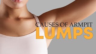 How To Treat Your Symptoms And Understand The Causes Of Armpit Lump  Tiggio [upl. by Kram]