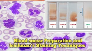 Blood smear Preparation l Leishmans Staining Techniques l Leishmans Staining Procedure ln Odia l [upl. by Ekul]