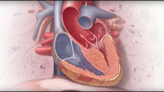 Genetics and Cardiomyopathy  Mayo Clinic [upl. by Baylor]