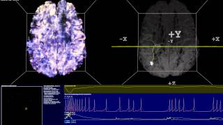 Simulation of Thalamocortical Brain Network  Spiking Neural Network 14M Neurons 140M Synapses [upl. by Attenohs570]