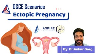 Ectopic pregnancy  OSCE Scenarios  Aspire Education  PLAB2 [upl. by Tony530]