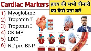 Cardiac Marker  Cardiac Profile Test  Heart Problems  Heart attack  Heart Disease  Cardiac [upl. by Iruj]