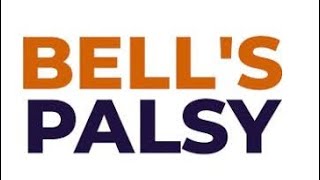 Bell’s palsyIDIOPATHIC FACIAL PALSY [upl. by Mikah947]