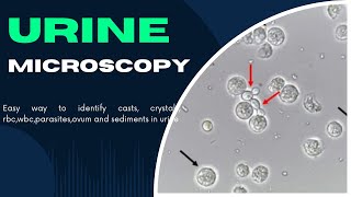 Complete Urine Microscopy Examination  How to identify CastsCrystalsRBCWBCParasiteOva in urine [upl. by Farrington71]