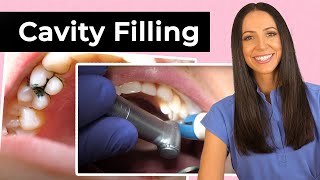 Dentist Filling a Cavity Between Teeth [upl. by Mella]