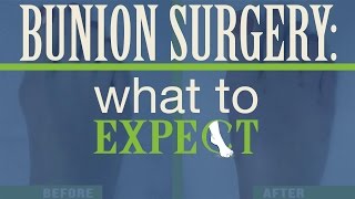 What Happens Before During and After Bunion Surgery [upl. by Adnuhsar]