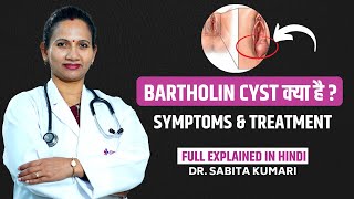 What Is Bartholin Cyst   बार्थोलिन सिस्ट क्या है और इसका इलाज कैसे होगा [upl. by Rozek]