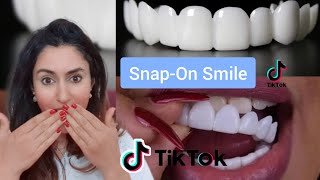 Orthodontist Reacts To SnapOn Veneer TikToks [upl. by Lobiv441]