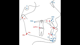 Lateral Cephalometric analysis تحليل أشعة الرأس الجانبية [upl. by Mailiw]