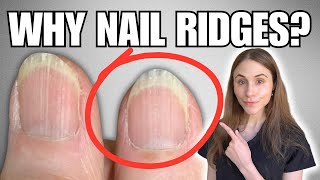 Why You Have Vertical Nail Ridges And How To Get Rid Of Them [upl. by Anad]