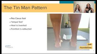 The Tin Man Pattern  Gait Foundations Course Sneak Peak [upl. by Enifesoj]