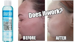 Clearskin Avon Blackhead Fresh Clarifying Toner Review Does the CLEARSKIN Toner work [upl. by Einner483]