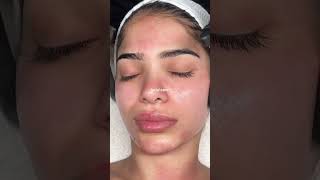 hydrafacialdermaplaning will leave you GLOWING facial [upl. by Huesman]