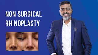 NonSurgical Rhinoplasty  Treatment Results Benefits amp Cost By Dr Sunil Richardson [upl. by Idell]