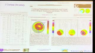 CXL corneal diagnostics Custom Ablations ASCRS 24 [upl. by Lemaj]