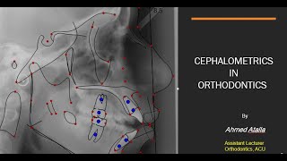 Cephalometrics in orthodontics By Dr Ahmed Atalla [upl. by Yentruoc]