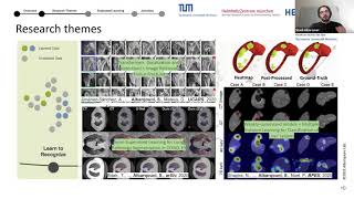 Towards Deep Federated Learning in Healthcare Invited Talk at CVPR21 MCV [upl. by Aicad40]