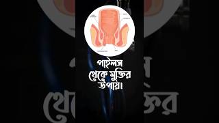 পাইলস থেকে মুক্তি  Nitricum Acidum  piles পাইলস [upl. by Nerraj264]