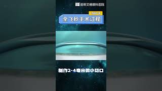 动图演示全飞秒手术全过程 近视手术 科普 分享 [upl. by Kaete286]