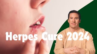 Herpes Simplex Virus Type 1 Cure amp Treatment 2024  The Elementary Info [upl. by Chemash]