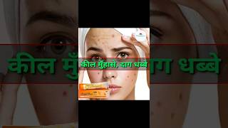 गोरे होने की क्रीम  Aqui Plus Cream  Aqui Plus cream uses in hindi viral shorts [upl. by Joshua546]