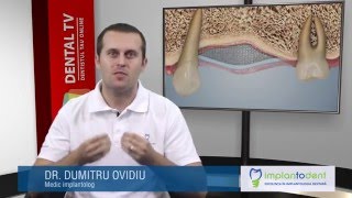 Aditia si augmentarea osoasa  Dr Dumitru Ovidiu [upl. by Burg431]