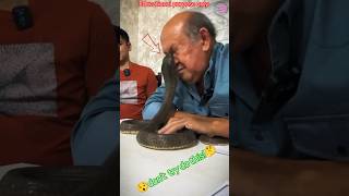 A Black Mamba Snake Bite the man Eyes  Most Dangerous Videos snake bite deng facts [upl. by Yeclek]