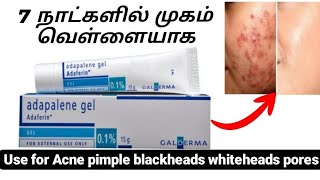 Adapalene gel uses in tamil  best oilment to reduce pimple and acne  skin whitening cream [upl. by Valerlan]