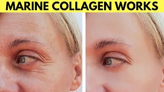 Marine collagen before and after [upl. by Nauqad]