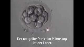 LAH  Laser Assisted Hatching Die Schlüpfhilfe  Kinderwunschzentrum an der Wien [upl. by Selokcin]