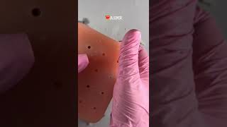 ASMR ear cleaning asmrsounds asmr blackdots asmrcosmetologist viral skincare acnetreatment [upl. by Bray357]