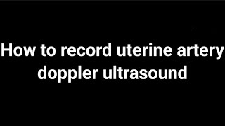 How to measure uterine artery doppler ultrasound [upl. by Leelahk]