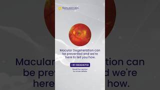 Macular Degeneration  Treatment and Precaution  Visit Sanjeevan [upl. by Ddat]