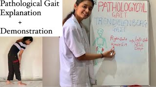 Pathological Gait  Exercise Therapy  Types Explained  physiotherapy [upl. by Hathcock]