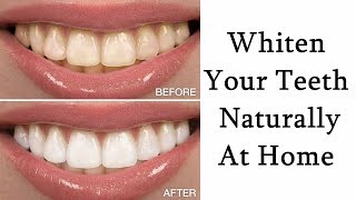 How To Whiten Teeth At Home With Baking Soda and Toothpaste [upl. by Swehttam]