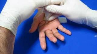 Hand Injection Techniques  Trigger Finger [upl. by Doersten]