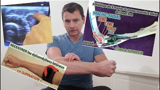 Épicondylite Latérale  AutoOstéopathie par Adhésiolyse Manuelle tennis elbow [upl. by Xonk]