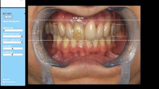 Digital Smile System DSS  tutorial italian [upl. by Avictor160]