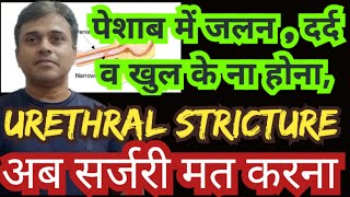 urethral stricture treatment with homeopathic medicines [upl. by Evvy296]