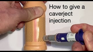 How to give a Caverject injection for ED [upl. by Eelrebmik]