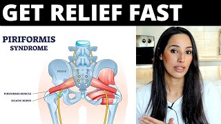 7 Piriformis Syndrome Tips to Get FAST Relief No Exercises or Stretches [upl. by Powder864]