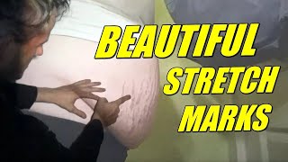 The incredible beauty of womanly stretch marks [upl. by Akiraa255]