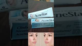 acnestar gel review  acnestar gel kaise use kare youtubeshorts shortsvideo shorts ytshorts [upl. by Borg758]