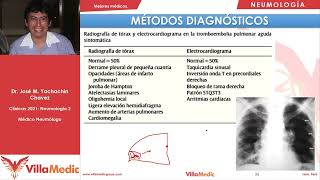 Tromboembolismo pulmonar  Neumología  Resumen más completo [upl. by Witha]