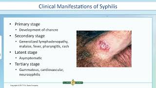 Serological Detection of Bacterial Infections [upl. by Elletnuahc]